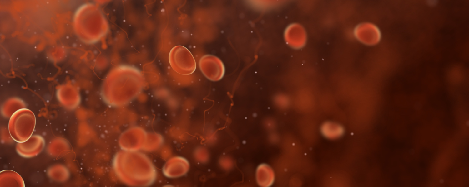 Vitamin C for Pre-Cancer Blood Disorders: Expert Trial Reaction